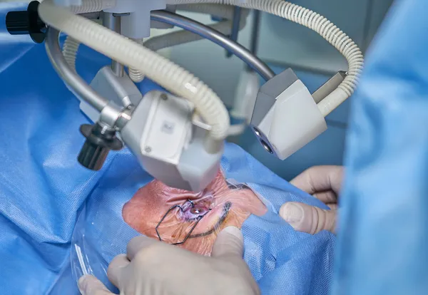 Nove pessoas são orientadas a retirar globo ocular após cirurgias